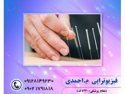 بهترین فیزیوتراپی در تهران