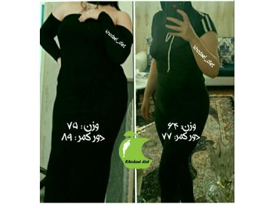 لاغری موضعی تبریز