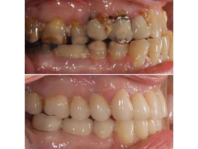 دندان سازی-مرکز کاشت دندان و زیبایی