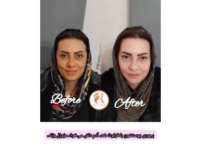 کلینیک پوست و مو رویامیس در شهرک امید و شهرک گلستان