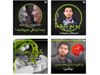 متخصص کاشت ایمپلنت در مشهد 