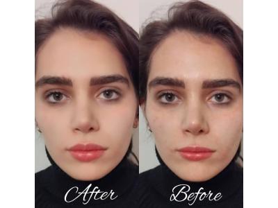 کلینیک پوست و مو رویامیس در شهرک امید و شهرک گلستان