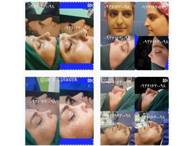  دکتر مهدی عرفانی متخصص جراح زیبایی در تهران