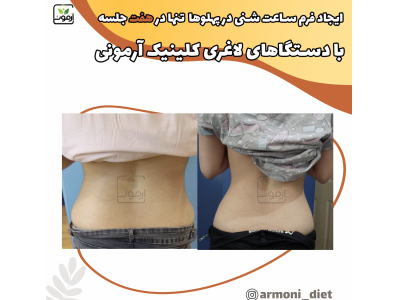 لاغری در تبریز بادستگاه