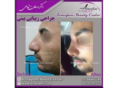 لیپوماتیک ، لیزر ، پیکرتراشی ، تزریق ژل و بوتاکس 