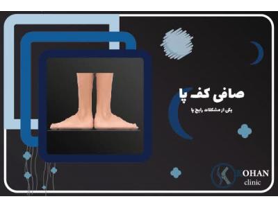 اسکن پا مرزداران-اسکن کف پا و کفی طبی غرب تهران – کلینیک تخصصی سلامت پا کهن