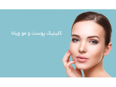 لیزر موهای زائد محدوده تهرانپارس