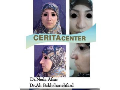 جراحی زیبایی بینی ، جراحی فک و ایمپلنت در تهران 