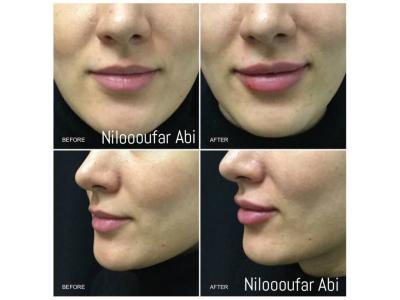 کلینیک تخصصی زیبایی در رودهن  و بومهن