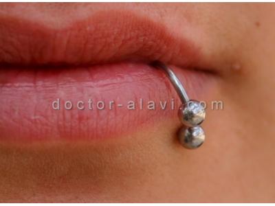 پاکسازی پوست و رفع جوش