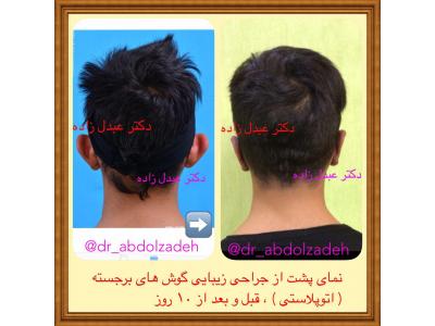 جراحی و زیبایی ترمیمی ، جراحی زیبایی بینی  ،  پیکرتراشی به روش لیزر لیپولیز و لیپوماتیک