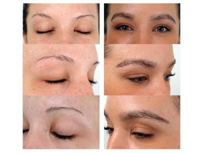 کاشت ابرو بصورت کاملا تخصصی