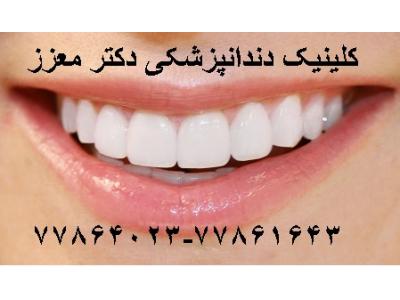 کلینیک دندانپزشکی دکتر محمدرضا معزز جراح ، دندانپزشک متخصص ایمپلنت در تهرانپارس