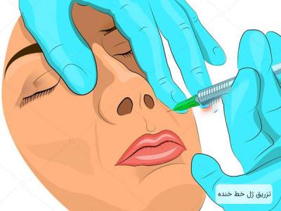 بوتاکس در شیراز