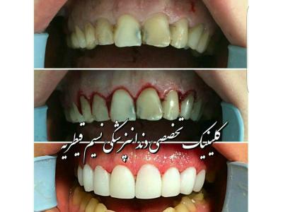 دندانپزشکی در منطقه یک تهران ،  کلینیک دندانپزشکی نسیم قیطریه