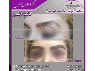 لیپوماتیک ، لیزر ، پیکرتراشی ، تزریق ژل و بوتاکس 