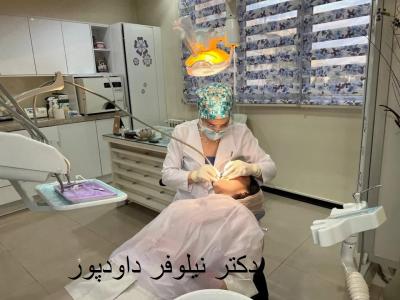 کود ریشه-دندانپزشک زیبایی و درمان ریشه  در شریعتی - قبا - دروس