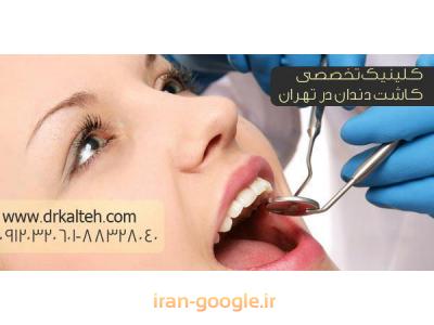 جراح ایمپلنت های دندانی و دندانپزشک در تهران 