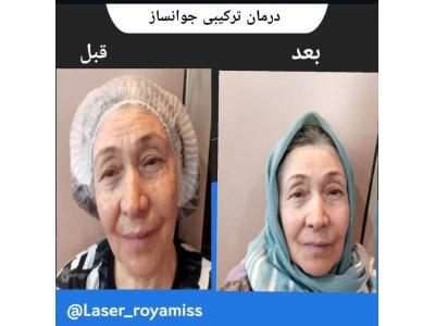 کلینیک پوست و مو رویامیس در شهرک امید و شهرک گلستان