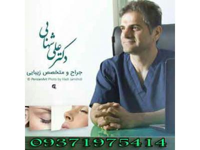 لیفت ابرو-کلینیک جراحی بینی دکتر علی شهابی