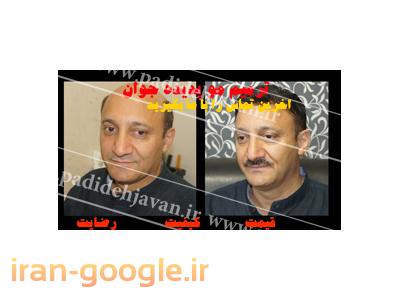 مرکز تخصصی کاشت و ترمیم مو پدیده جوان