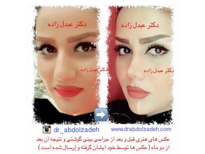 جراحی و زیبایی ترمیمی ، جراحی زیبایی بینی  ،  پیکرتراشی به روش لیزر لیپولیز و لیپوماتیک