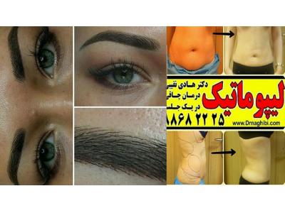 لیپوماتیک دکتر نقیبی ، پیکرتراشی دکتر نقیبی ، کاهش وزن دکتر نقیبی
