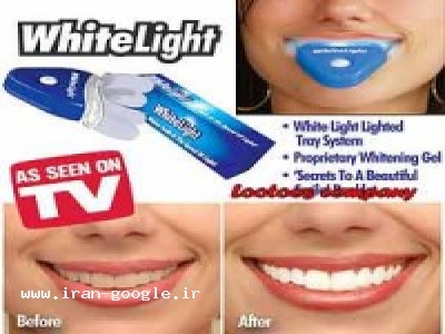 سيستم سفيد كننده دندان white light 