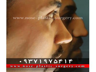 گودی-کلینیک جراحی بینی دکتر علی شهابی