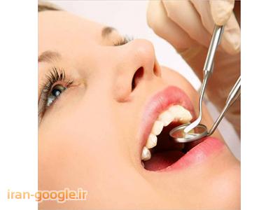 روکش دندان-مرکز دندانپزشکی دکتر بلاش آبادی