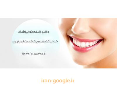 جراح ایمپلنت های دندانی و دندانپزشک در تهران 