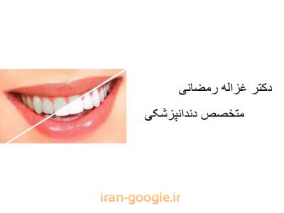 ترمیم دندان-دکتر غزاله رمضانی متخصص پروتز ثابت و متحرک ، ایمپلنت و طراحی لبخند