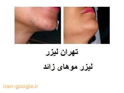 کلینیک مزوتراپی پوست-تهران لیزر کلینیک  تخصصی لیزر موهای زائد ، جوانسازی و لایه برداری پوست 