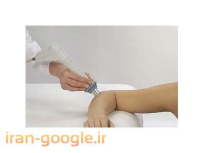 شوک ویو روش درمانی جدیدی برای خار پاشنه و تنیس البو و تاندنیت کلسیفیک در شانه 