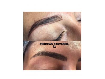 میکروبلیدینگ فیبروز ،حجیم سازی لب ، بن مژه 