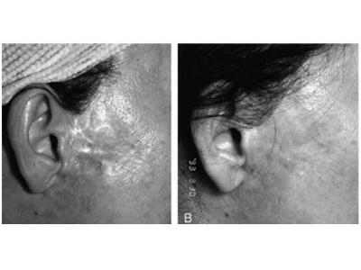 کلینیک تخصصی طب سوزنی دکتر سیامک ترابی نژاد