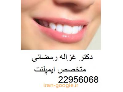 درمان ریشه دندان-دکتر غزاله رمضانی متخصص پروتز ثابت و متحرک ، ایمپلنت و طراحی لبخند