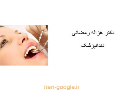 دکتر غزاله رمضانی متخصص پروتز ثابت و متحرک ، ایمپلنت و طراحی لبخند