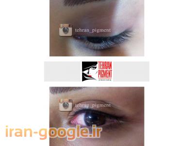 مرکز تخصصی میکروپیگمنتیشن تهران پیگمنت