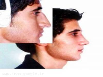جراحی زیبایی تهران-جراحی پلاستیک بینی و صورت با کمترین درد