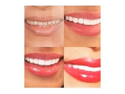 کلینیک تخصصی ایمپلنت  و کامپوزیت ونیر مشاهیر