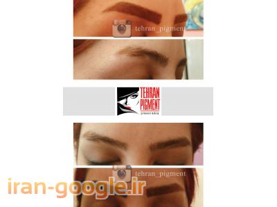 مرکز تخصصی میکروپیگمنتیشن تهران پیگمنت