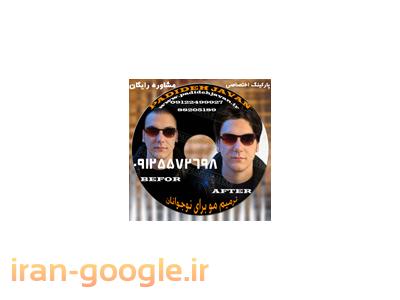 کلینیک کاشت و ترمیم مو پدیده جوان(تار به تار)