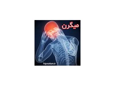 هیپنوتراپی-درمان میگرن،بی خوابی واضطراب با هیپنوتراپی در زنجان