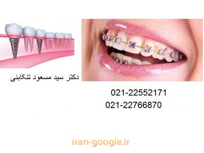 کاشت دندان-جراح ایمپلنت در محدوده پاسداران 