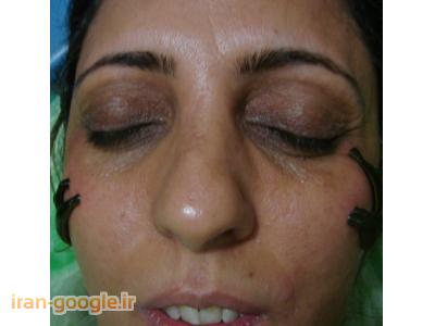 لک و چروک پوست-زالو درمانی در شیراز