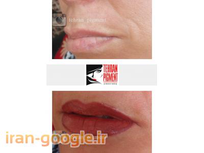 مرکز تخصصی میکروپیگمنتیشن تهران پیگمنت