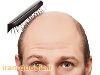 موهای-درمان گیاهی و کامل موخوره شوره سر شکنندگی موهای آسیب دیده با پک شامپو و لوسیون ژیوار