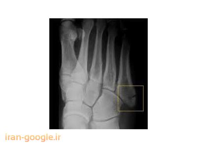 دکتر علی عالمی متخصص ارتوپدی و شکسته بندی 