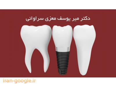 جراح دندانپزشک- جراح ، دندانپزشک و متخصص ایمپلنت در محدوده خانی آباد 